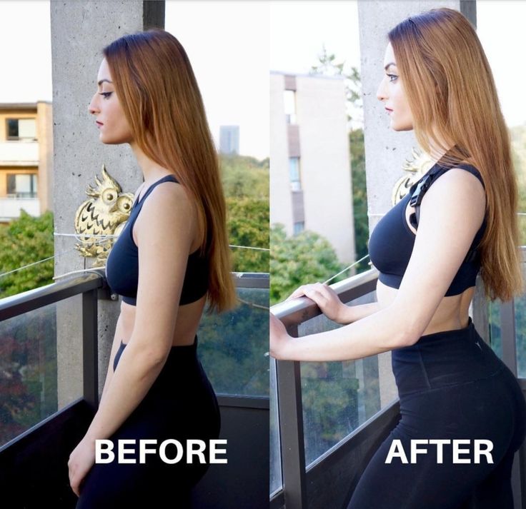 Free Size Posture Corrector For Men And Women Back Support Belt Back Pain Back Straight And Shoulder Support Belt (Universal Size) (Metallic Belt) (Posture Corrector Belt)